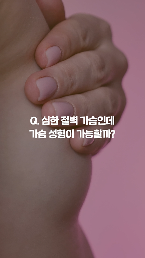 영상 썸네일 1