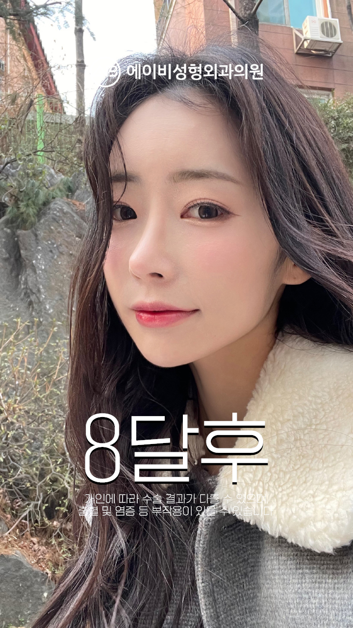 영상 썸네일 1
