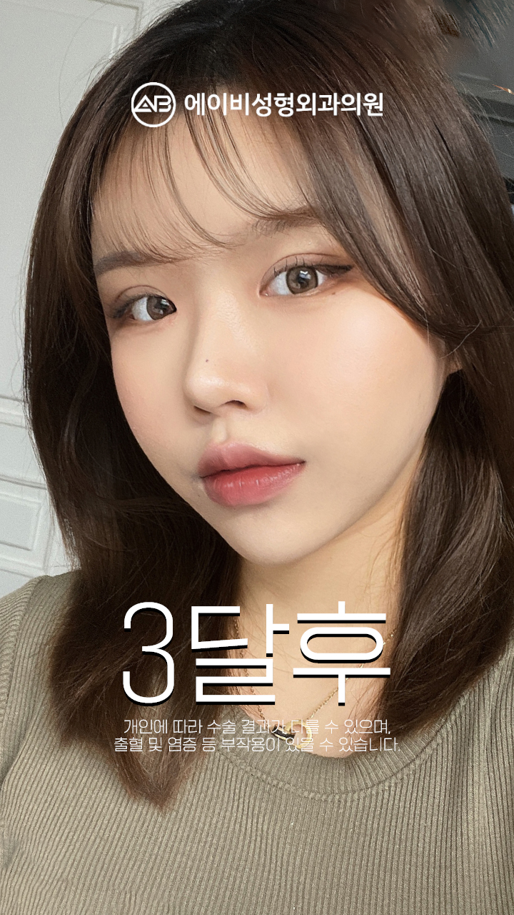 영상 썸네일 3