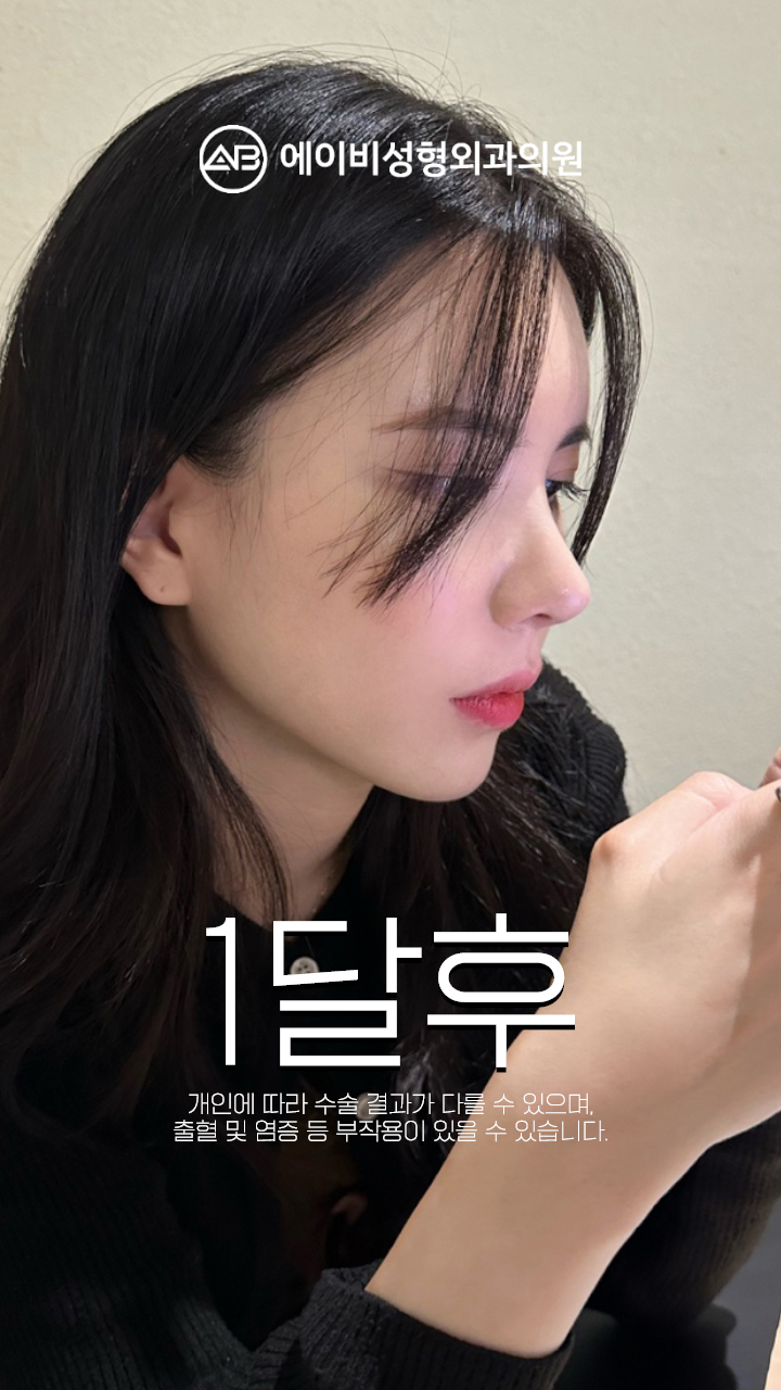 영상 썸네일 1