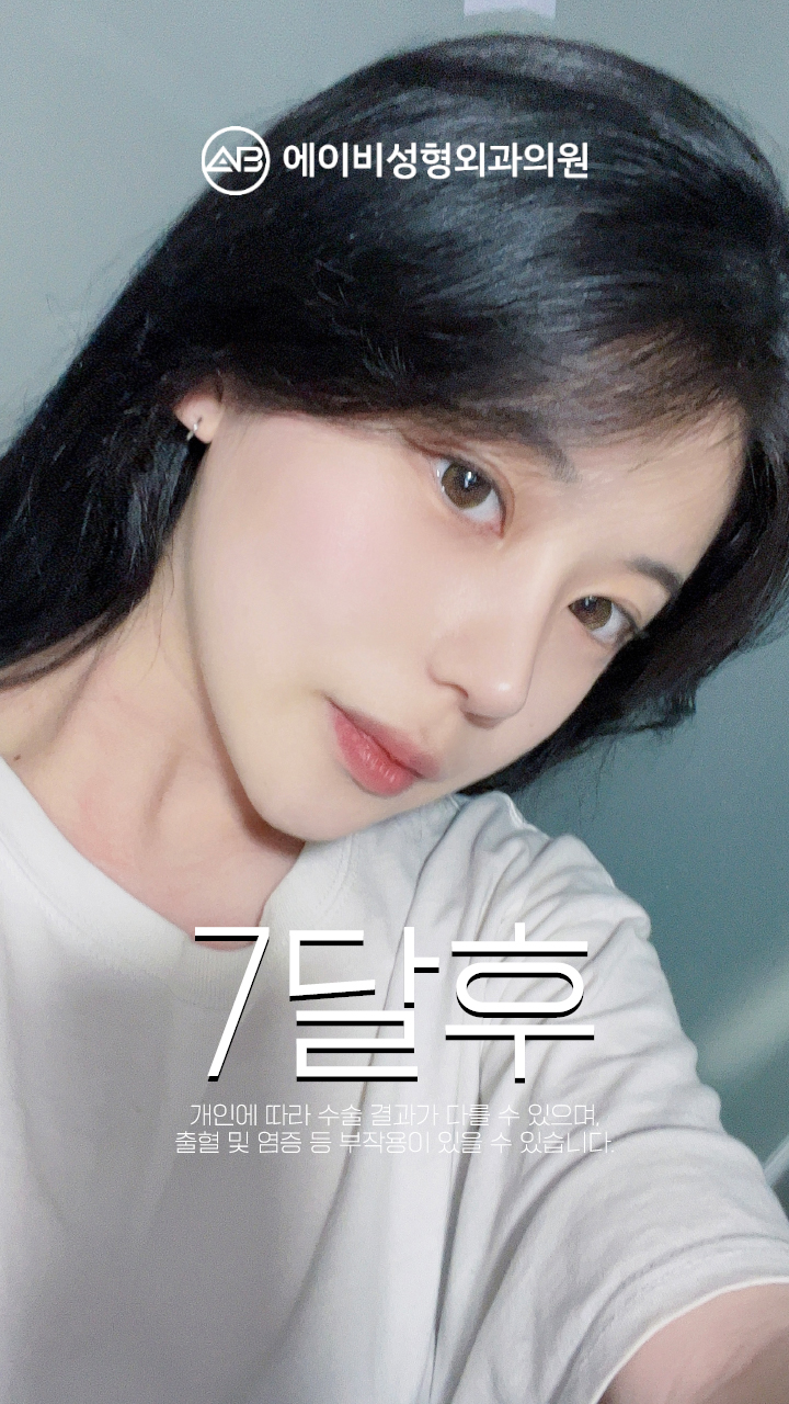 영상 썸네일 2