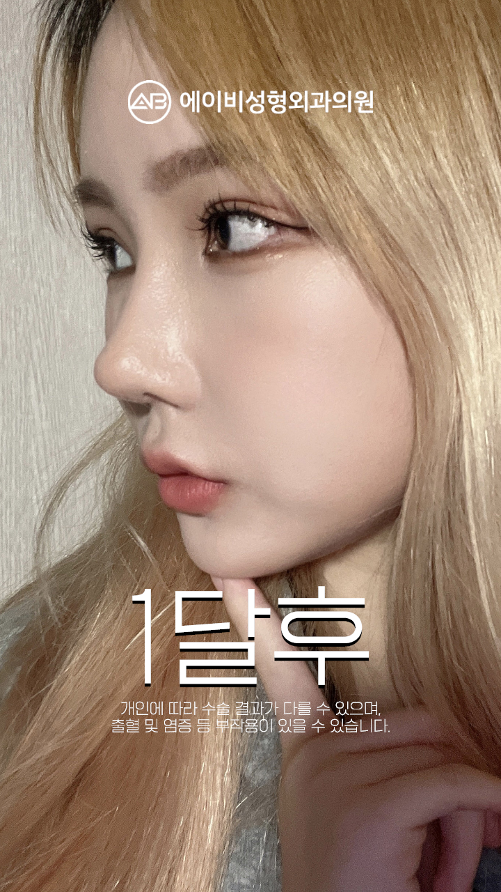 영상 썸네일 4