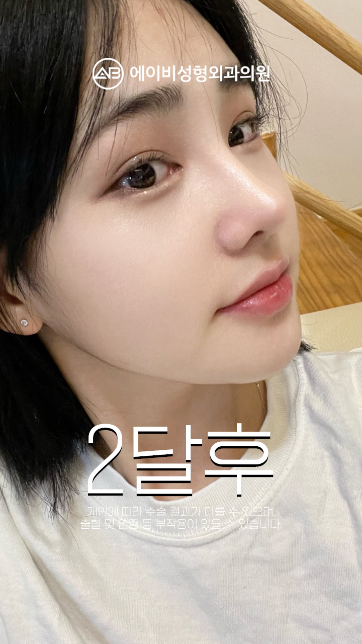 영상 썸네일 5
