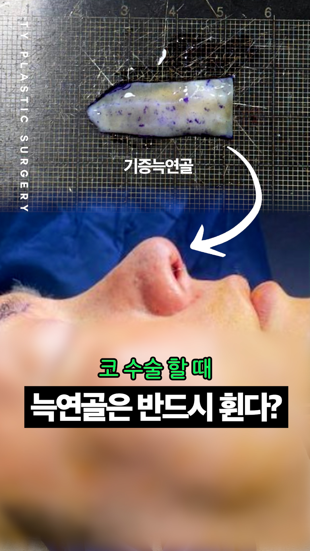 영상 썸네일 1