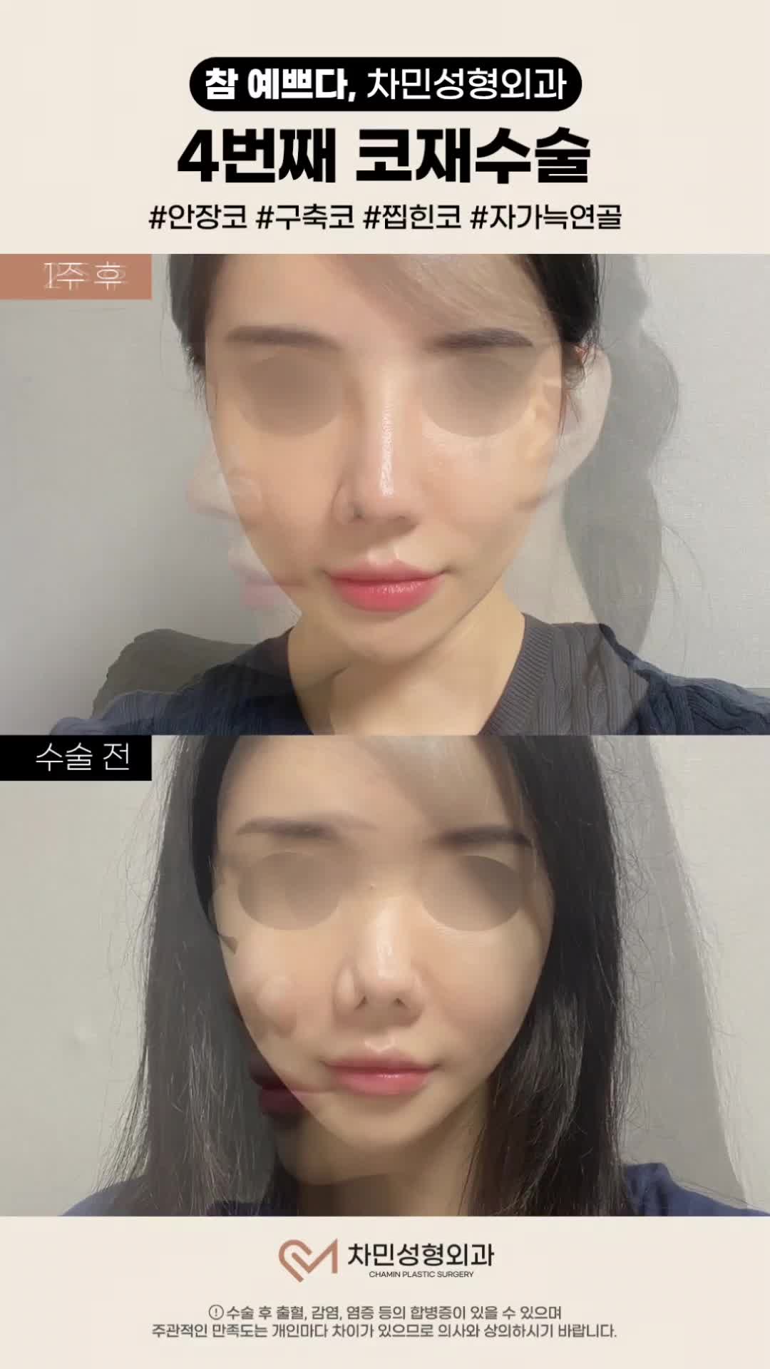 영상 썸네일 1