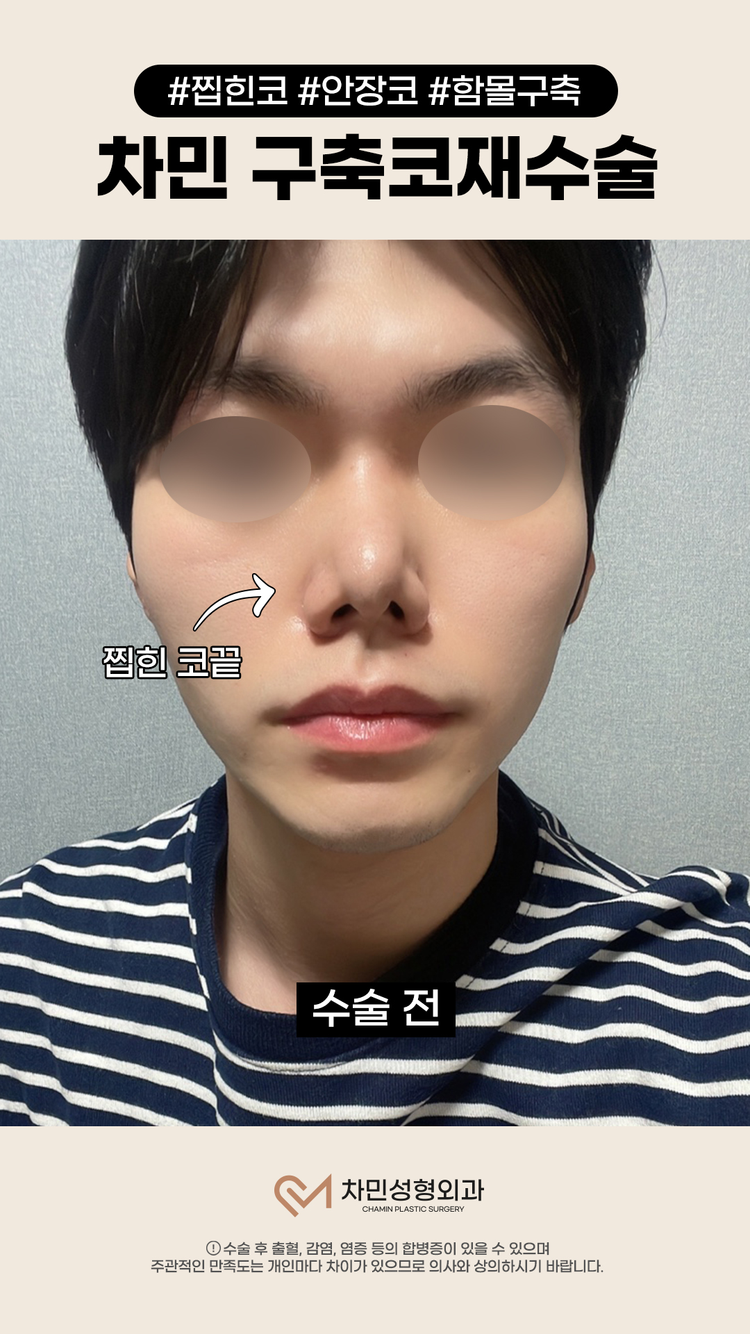 영상 썸네일 2