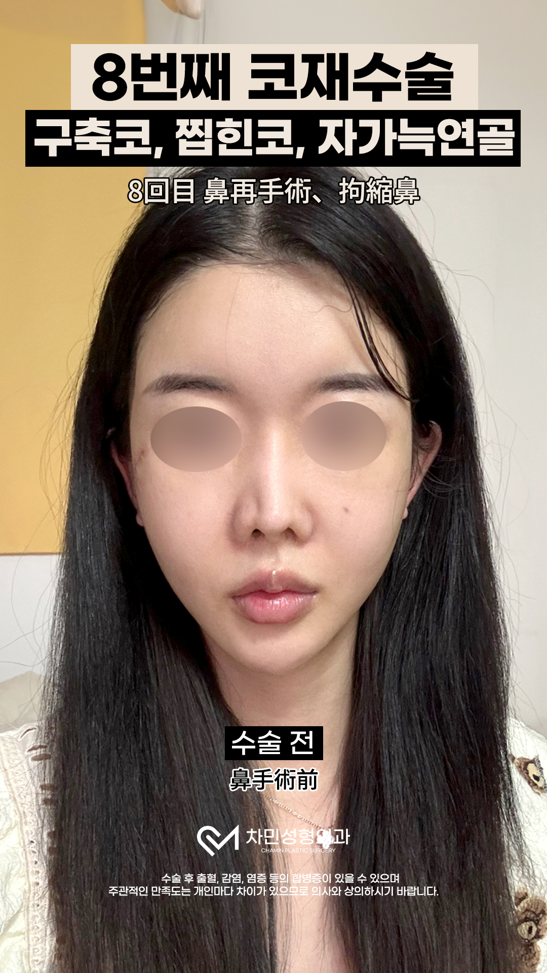 영상 썸네일 3