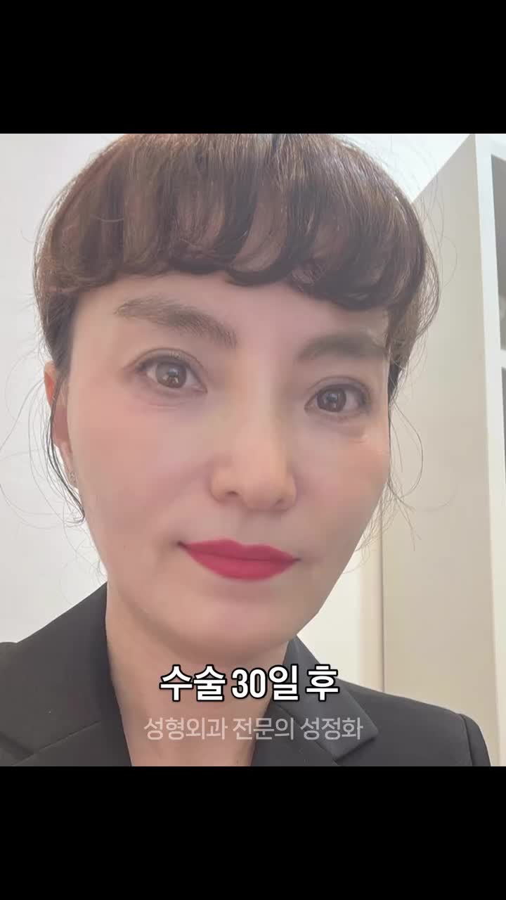 영상 썸네일 1
